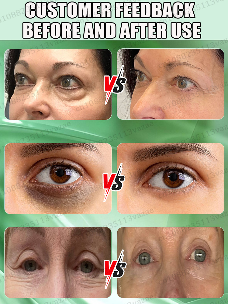 оставайся подогревом эссенции для глаз, сохраните свои глаза навсегда молодые