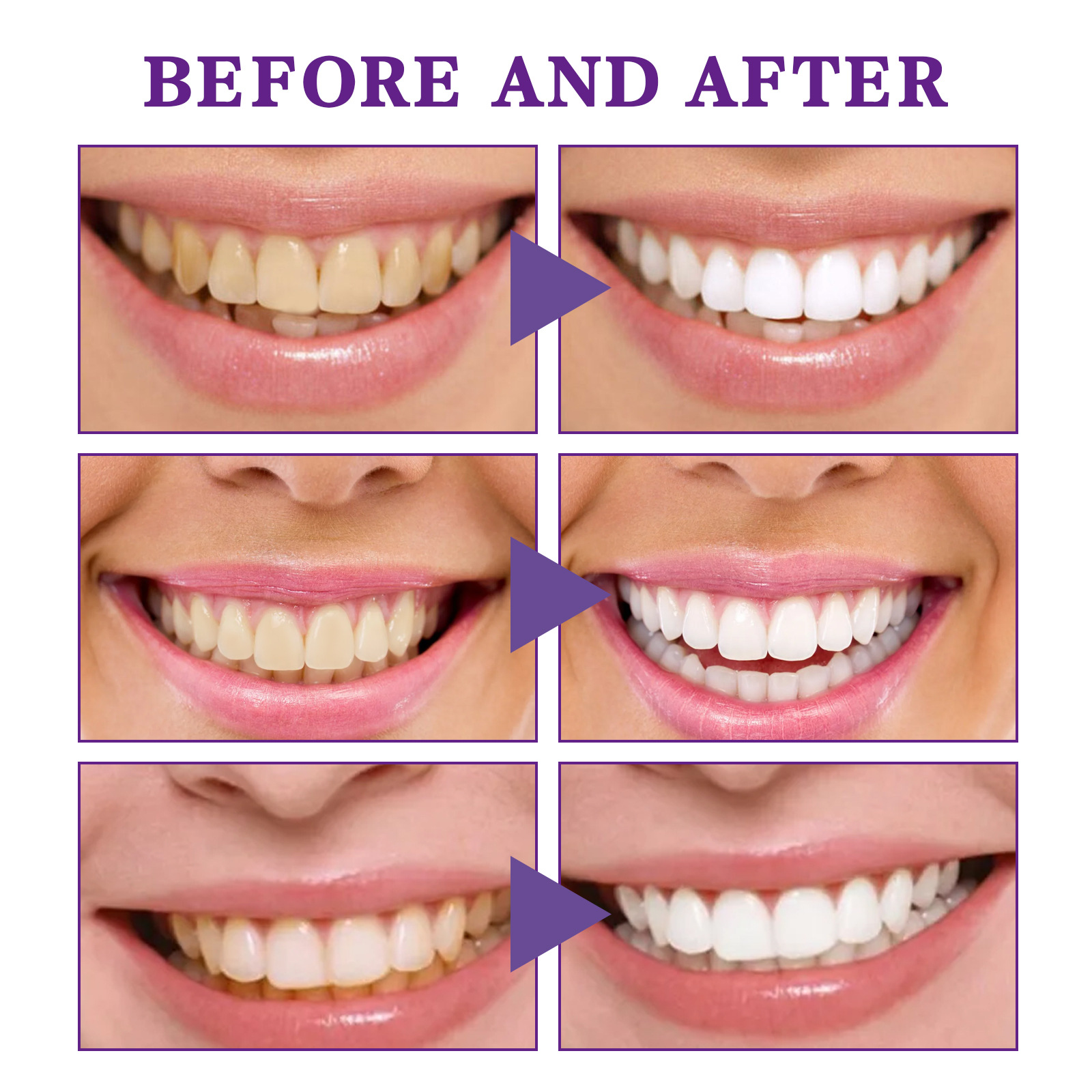 Purple Anti-Allergic Pressing Toothpaste Cavity Prevention Teeth Whitening Toothpaste Fresh Breath and Clean Teeth Care for Gums