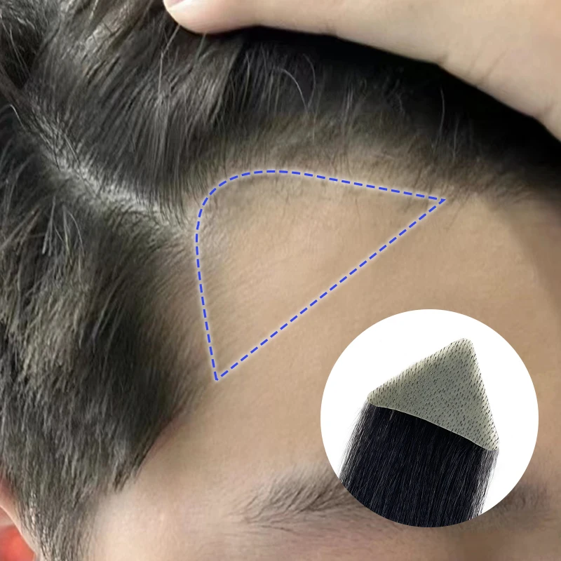 Parche para la frente de cabello humano Real, peluquín para patillas, Invisible, sin costuras, piel ultrafina, PU, parche para patillas de línea de cabello para hombres