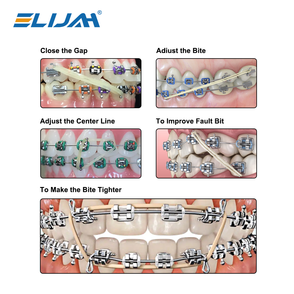 5000 ชิ้นทันตกรรมยาง Band จัดฟัน Ligation O - แหวนสัตว์ Traction แหวน Fox Chipmunk กระต่ายจัดฟัน Braces Elastics