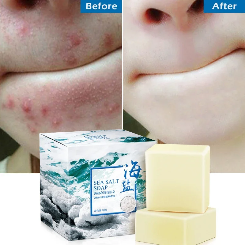 lang.product_image