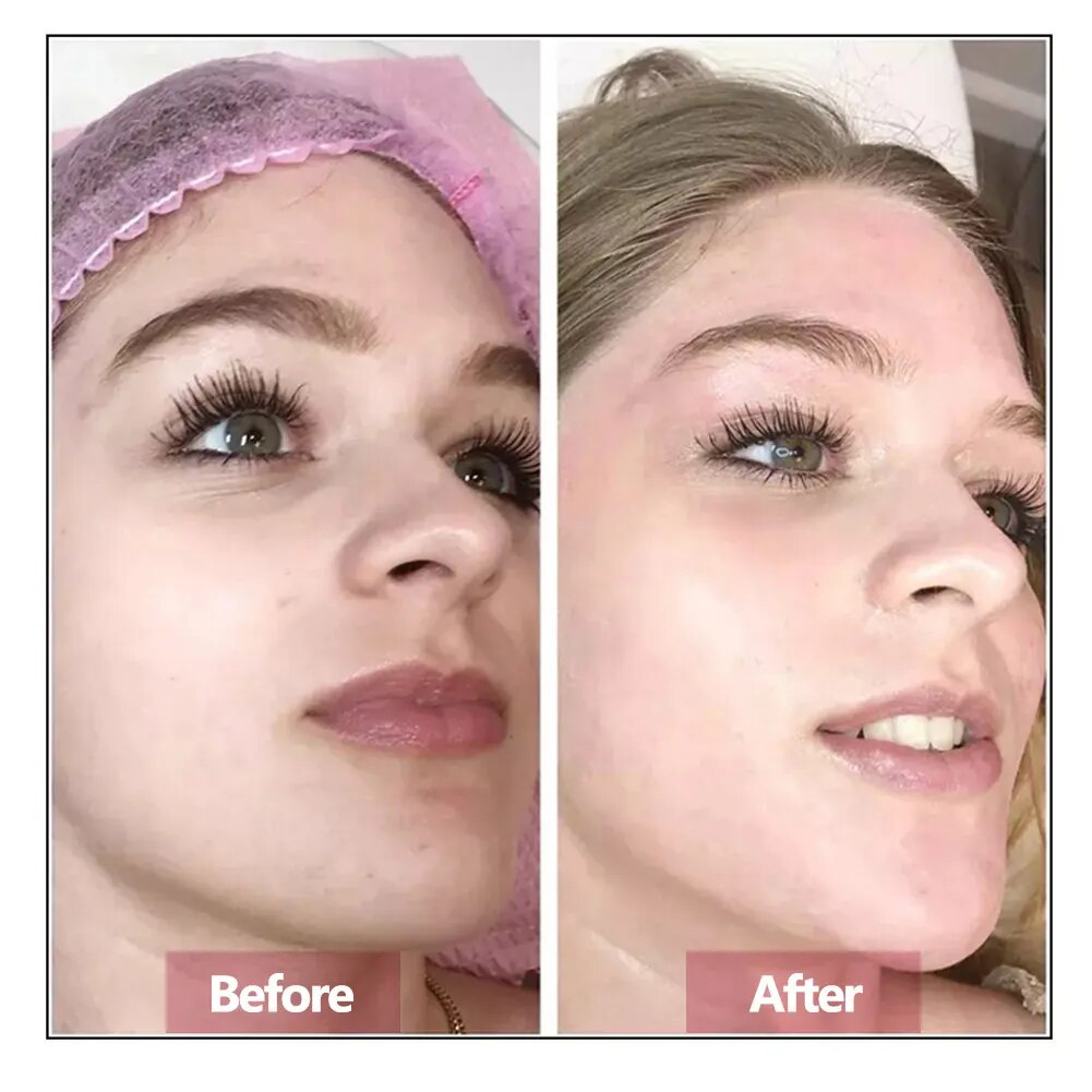 Sérum pour le visage à l'acide hyaluronique, essence de réparation de la peau, soin raffermissant, hydratant, anti-âge