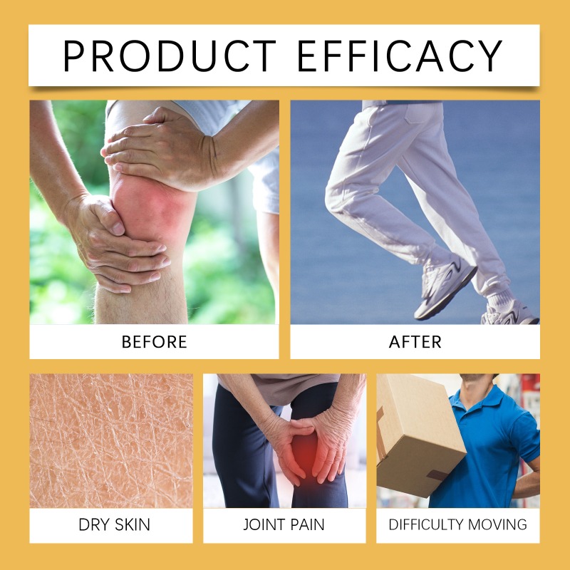 Bee Venom Turmeric Arthritis Therapy Cream Relieve Arthritis Pain Soothing Hand and Foot Joint Discomfort Massage External Cream