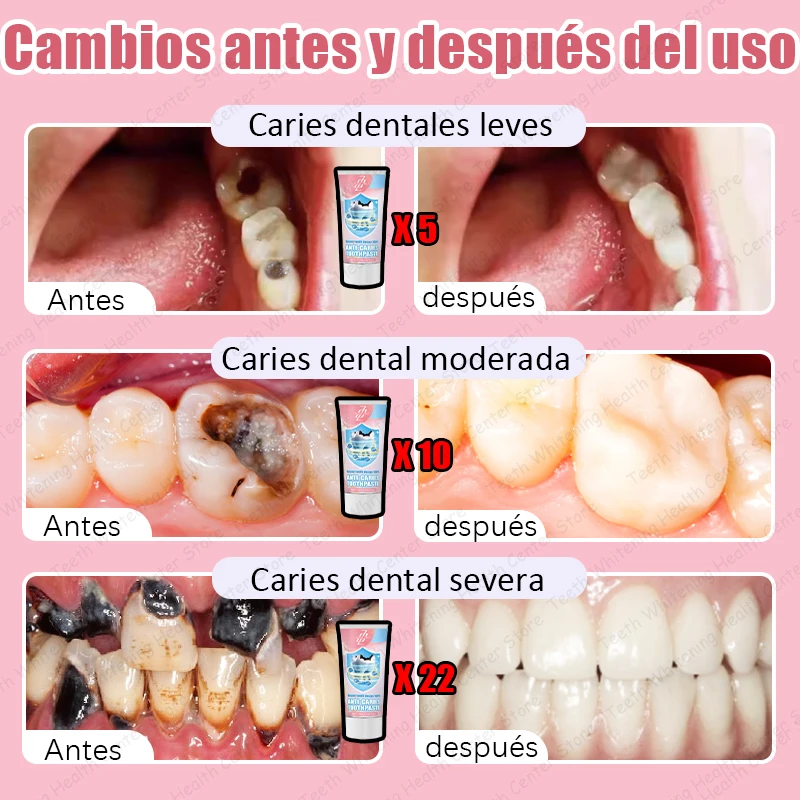Eʟ 99% ᴅᴇ ᴘᴇʀsᴏɴᴀs ʀᴇᴄᴏᴍᴘʀᴀ, ɢʀᴀɴ ᴏғᴇʀᴛᴀ, ʀᴇᴘᴀʀᴀᴄɪᴏ́ɴ ᴅᴇ ᴄᴀʀɪᴇs ᴅᴇɴᴛᴀʟᴇs