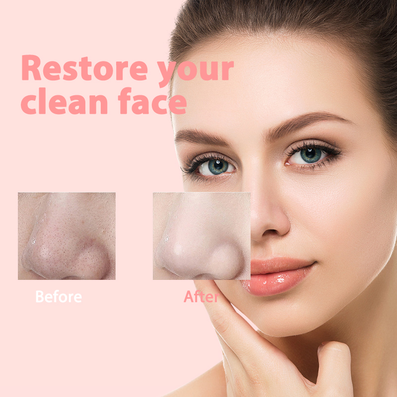 Removedor de cravo diamante dermoabrasão nariz vácuo poros limpador acne espinha sucção extrator usb recarregável ferramenta cuidados com a pele