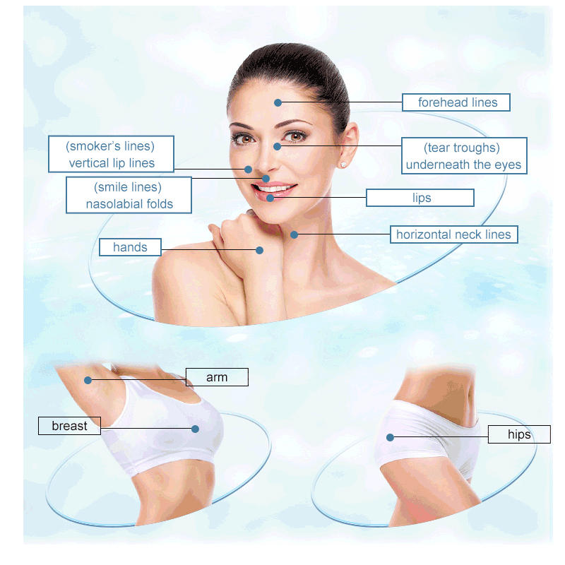 50pcs Factory Disposable Blunt-tip Cannula 22g 23G 25G 27G 18G 50mm/70 Blunt Fine Micro Body Piercing Needles Cannula Syringe