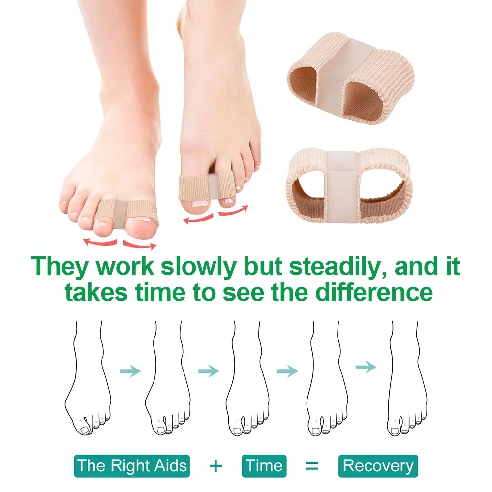 เจล Bunion Toe Separator W/ซับผ้าสําหรับ Big Toe, ซิลิโคน Toe Spacers Breathable Toe Corrector Protector สําหรับทับซ้อนกัน Toe