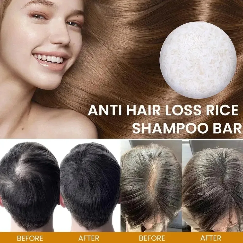 1/2/3pcs Biologische Rijst Shampoo Zeep Bar Reinigt Olie Gratis Conditioning Zeep Rijst Water Eiwit voedende Haargroei Zeep Bar