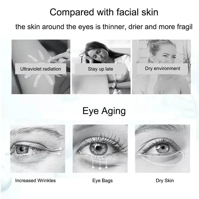 Creme para os olhos com nicotinamida, creme para olheiras, remove bolsas para os olhos, ácido hialurônico, soro hidratante contra inchaço, gel para cuidados com os olhos