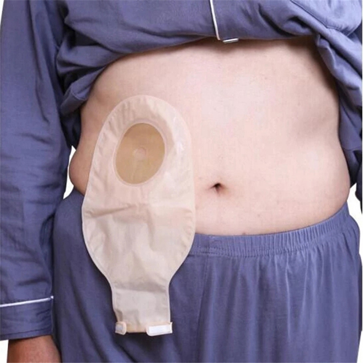 Sacos de ostomia a71p, 5 peças, bolsas drenáveis para colostomia, ileostomia, cuidados com a estoma, válvula de drenagem de 20-60mm, sacos de colostomia