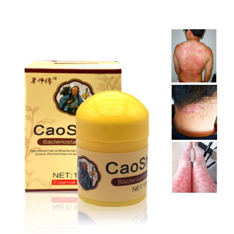 50G Vẩy Nến Eczma Kem Tác Phẩm Hoàn Hảo Cho Tất Cả Các Loại Các Vấn Đề Về Da Miếng Dán Massage Body Tinh Dầu Trung Quốc Thuốc Thảo Dược