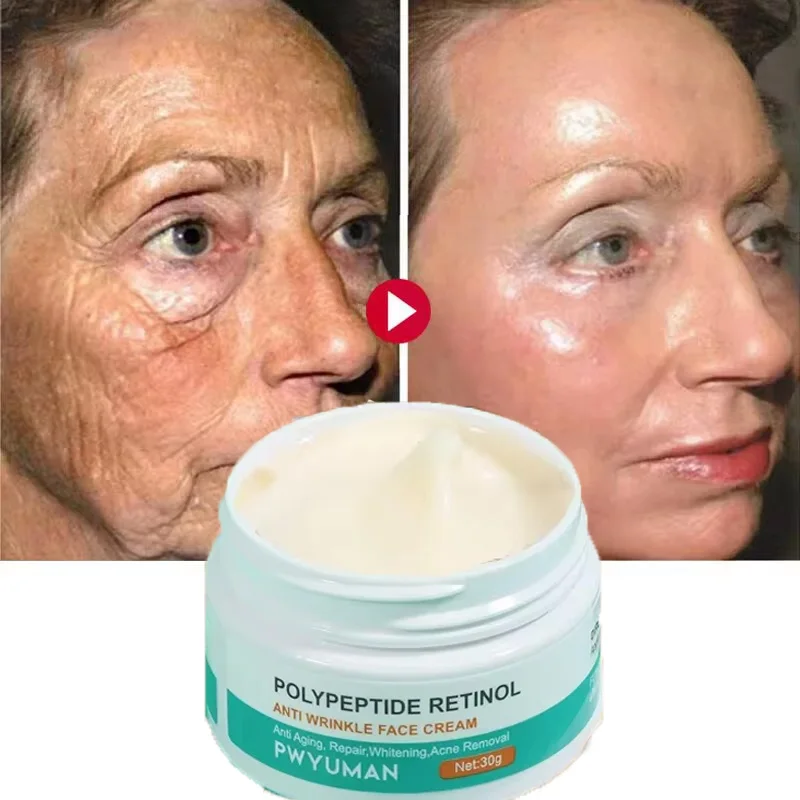 Retinol Wrinkle Remover Face Cream Firming Lifting Anti Aging Fade Fine Lines Moisturizing Whitening Repair Skin Care Cosmetics