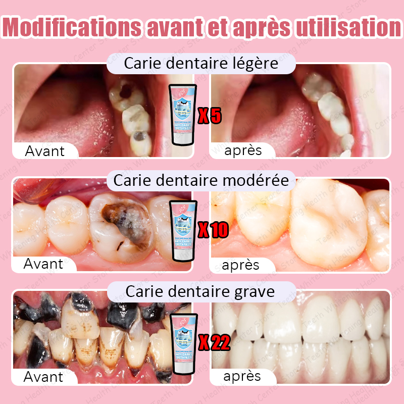 99% ᴅᴇ ᴘᴇʀsᴏɴɴᴇs ʀᴀᴄʜᴇᴛᴇʀ, ᴠᴇɴᴅʀᴇ ᴀ̀ ᴄʜᴀᴜᴅ, ʀᴇ́ᴘᴀʀᴇʀ ʟᴀ ᴄᴀʀɪᴇ ᴅᴇɴᴛᴀɪʀᴇ