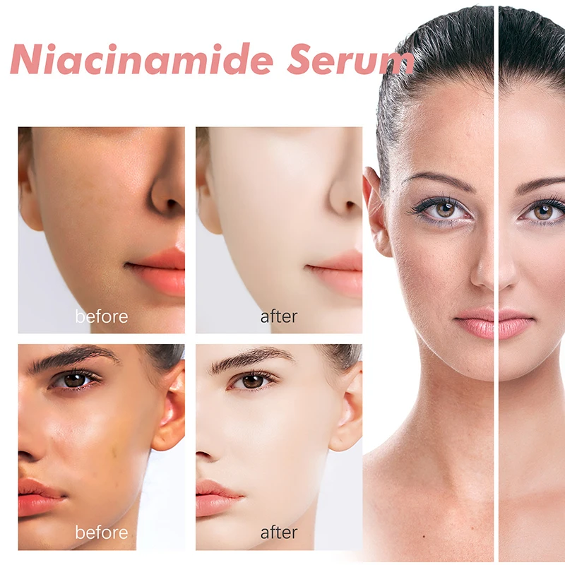 Pêssego 70% niacinamida soro 30ml hidratante evitar secura óleo essencial facial aumentando a elasticidade suave suavizar cuidados com a pele