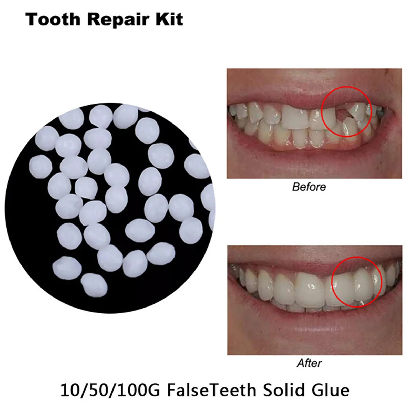 10g-100/bag Tooth Repair Kit-thermal Beads For Filling Fix The Missing And Broken Tooth Or Adhesive The Denture Fake Teeth Gutta