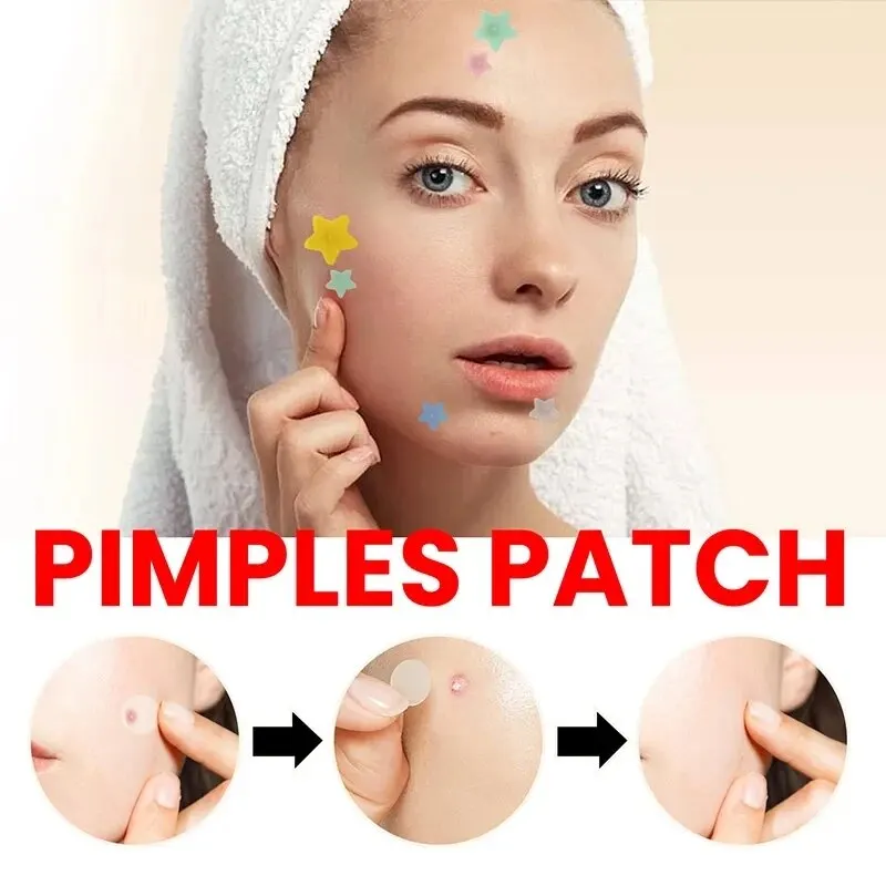 Parche de reparación de acné para el cuidado de la piel Facial, manchas, marcas de granos, manchas de acné cerradas, cubierta de granos de acné