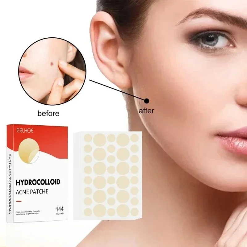 Parche hidrocoloide para acné, imperfecciones faciales, marcas de espinillas, cubierta cerrada para imperfecciones de acné, parche de reparación de espinillas, parche Invisible para acné