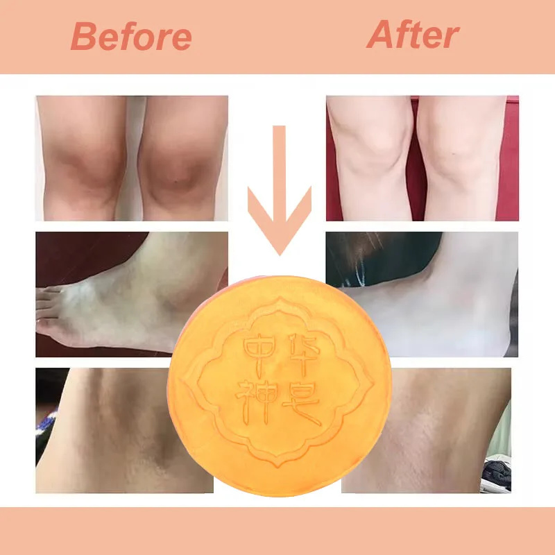 Sabonete clareador corporal, limpeza profunda, axilas, pernas, joelhos, axilas, branqueamento de pele de frango, sabonete para iluminar, cuidados com a pele suave e justo