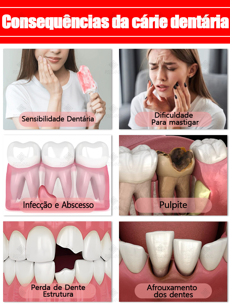 Repare a cárie dentária, livre-se da dor de dentes, restaure e branqueie os dentes