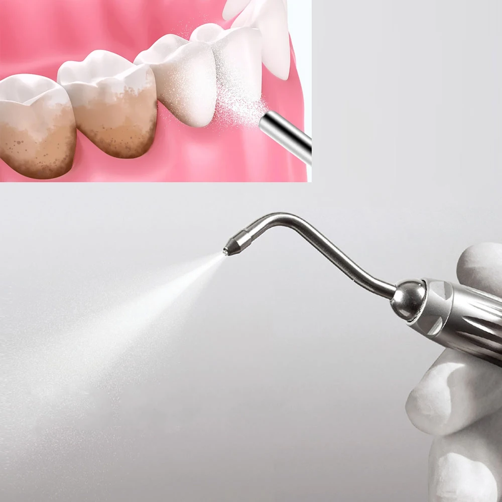 Dental Polierpulver Prophy Air Jet Flow Zahnreinigung Plaque Fleckenentfernung Natriumbicarbonat 130g Minze Zitrone Erdbeere