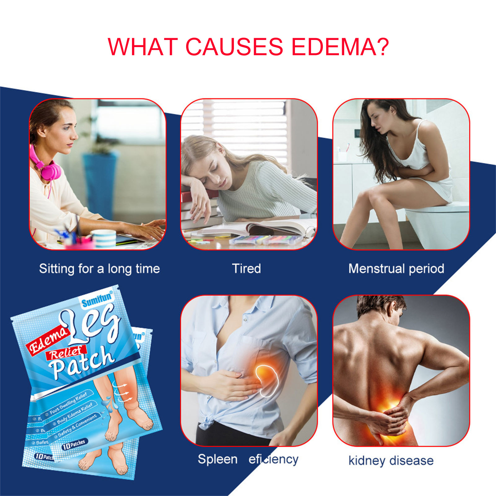 10 шт., пластыри от отеков и боли в ногах