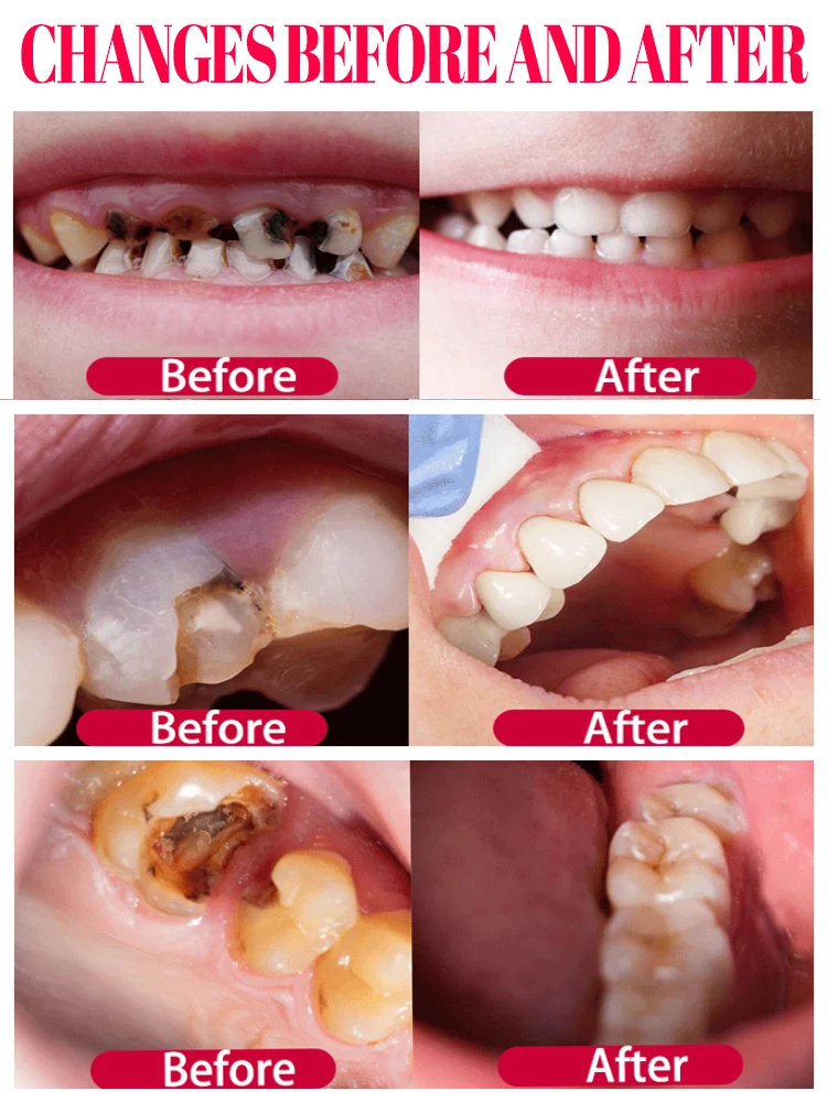 Reparar las caries, eliminar el dolor de muelas, restaurar y blanquear los dientes.