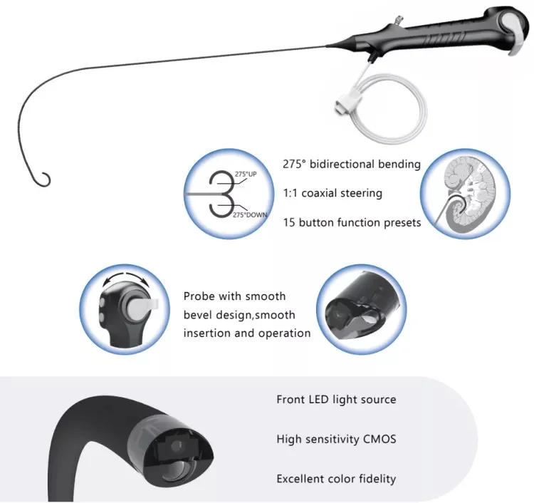 Geyi Single-use Digital Flexible Ureteroscope