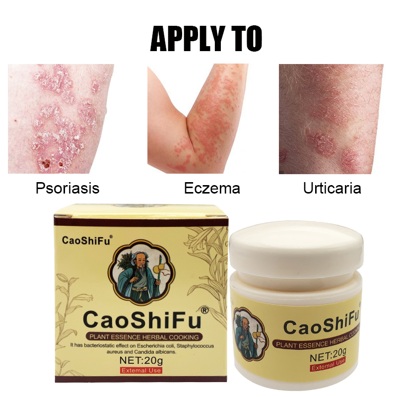 20g ZB Caoshifu medicina de hierbas chinas para Dermatitis ungüento eczematoide Psoriasis Urticaria crema para el acné cuidado de la piel