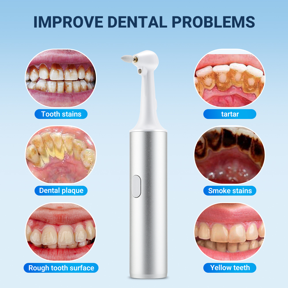 5 em 1 polidor de dentes elétrico usb recarregável raspador dental escova de dentes tártaro placa removedor de cálculo limpador clareamento dos dentes