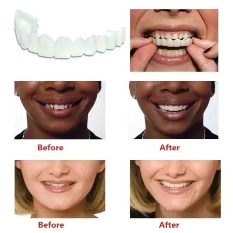 Ajuste perfecto para blanquear los dientes, cubierta de dientes falsos, carillas de silicona con sonrisa, herramienta de belleza superior, dientes cosméticos reutilizables