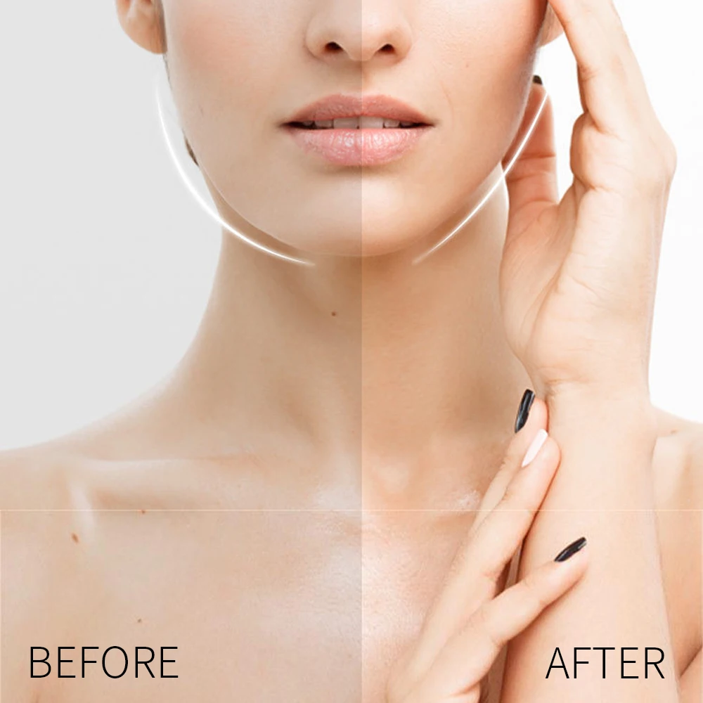 40 pièces/ensemble visage front joue menton autocollant visage Lifting Patch Anti-rides Anti-âge visage peau Lifting rides dissolvant bande