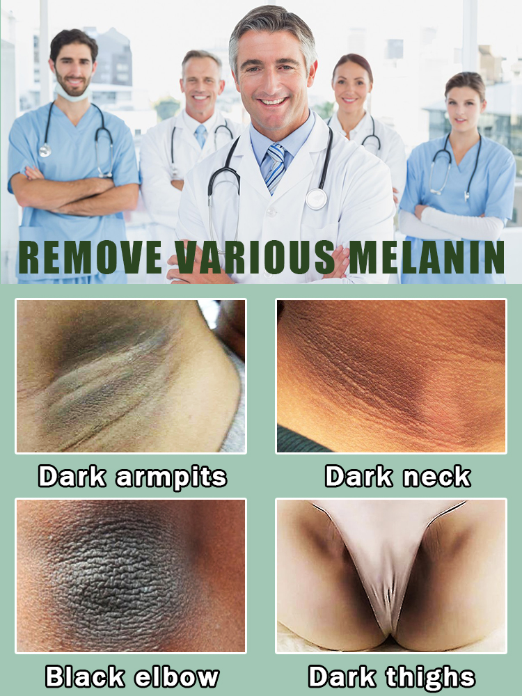 Скажи прощай в меланин