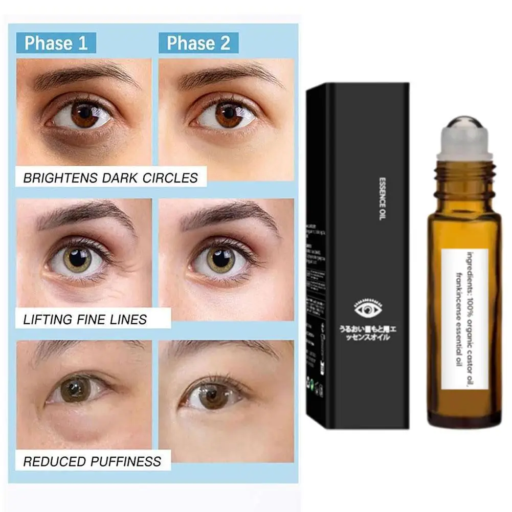 Original 1pcs 10ml Oil Ball Roller With Castor Oil And Mastic Castor Oil And Mastic Eye Ball