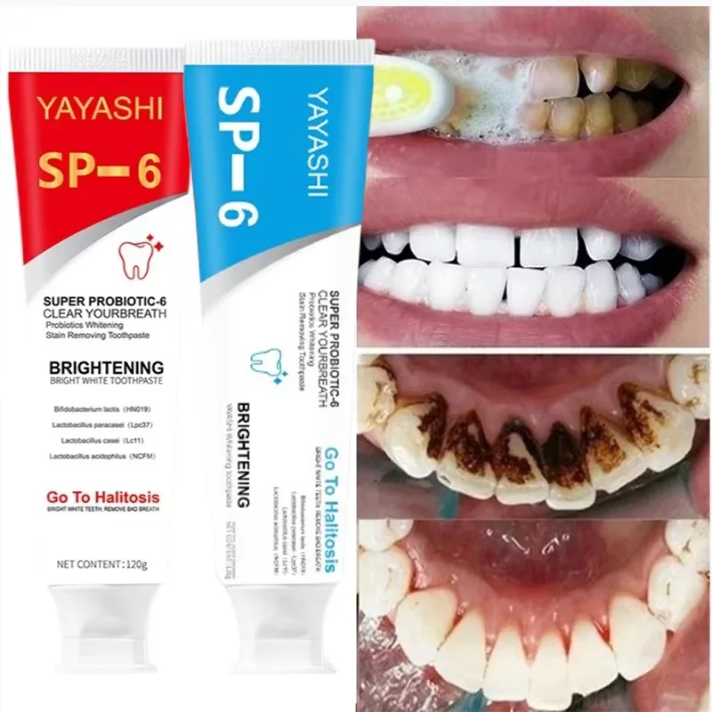 120g Probiotic Toothpaste SP-6 Whitening Tooth Remove Plaque Stains Teeth Whitener Oral Hygiene Clean Fresh Breath Dental