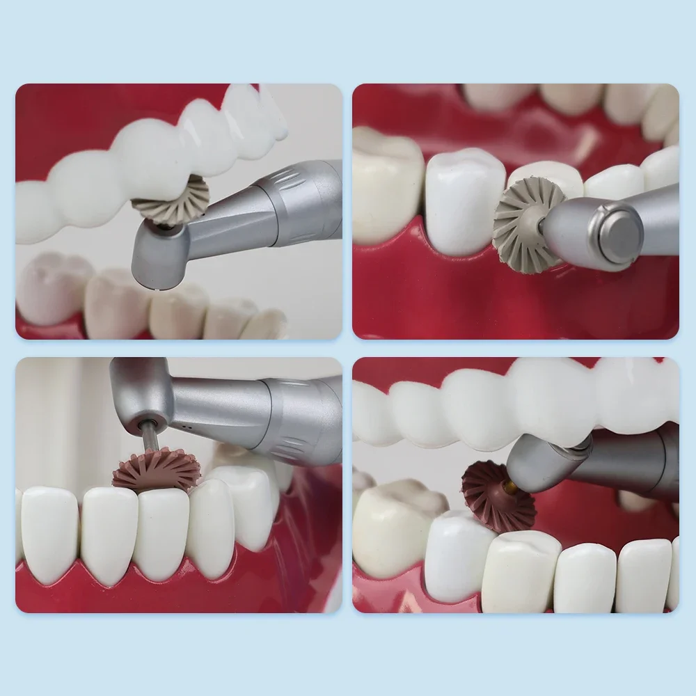 แปรงขัดฟัน6ชิ้นแผ่นขัดเรซินคอมโพสิตขนาด14มม. แปรงยืดหยุ่นแบบเกลียว3สี