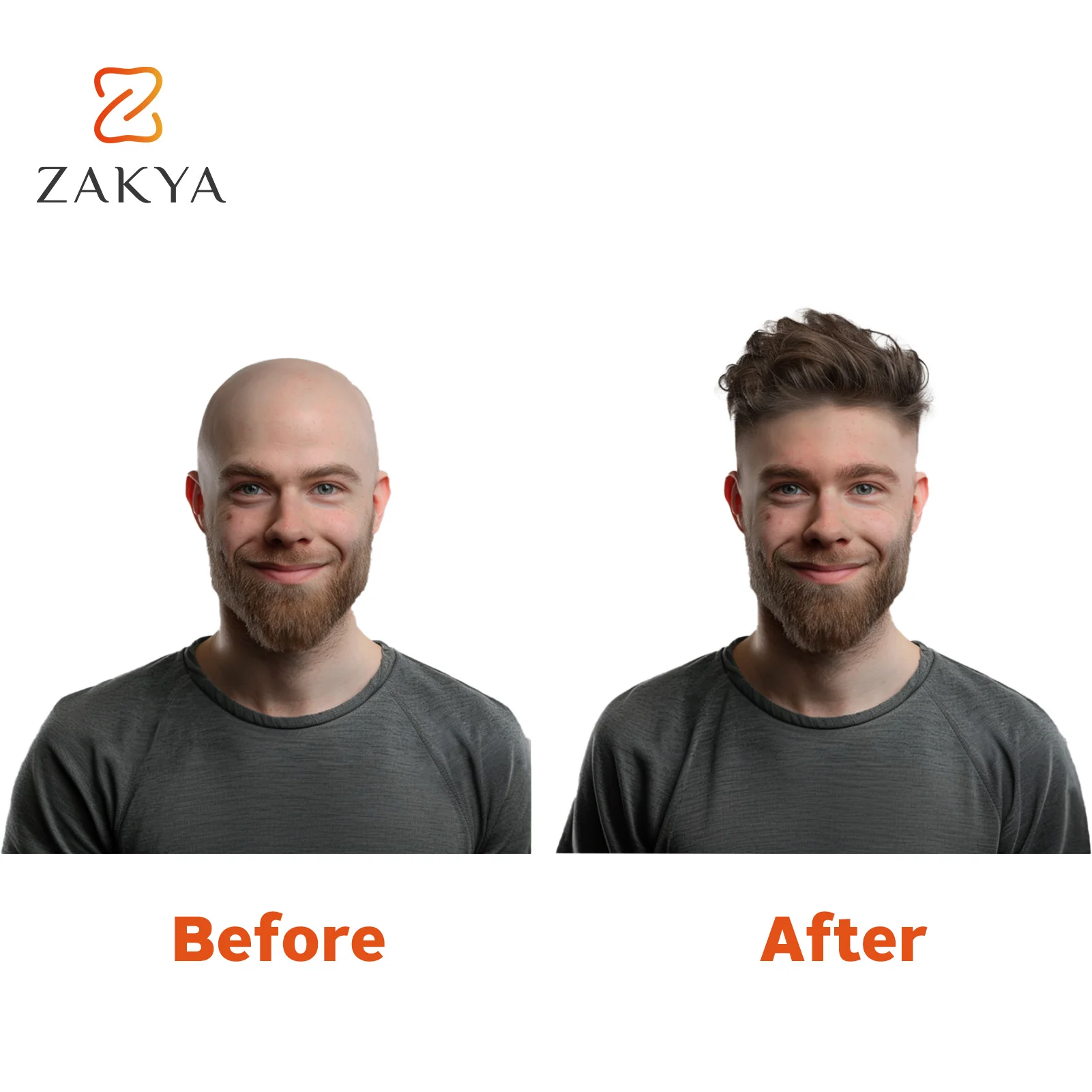 Front Mannen Toupetje Man Pruik Natuurlijke Haarlijn 100% Menselijk Haar Frontale Mannelijke Pruik Volledige Huid Haarstukken Haarstukje Zakya