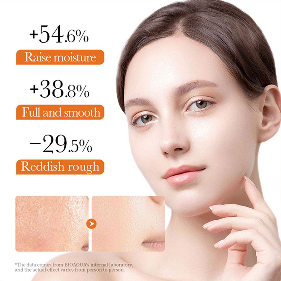 YOUNGCOME-VitaminC Creme Facial, SkinCare, Pigment Spots, Removedor de Sardas, Clareamento, Hidratante, Anit-Envelhecimento, Beleza, Saúde, Cosméticos