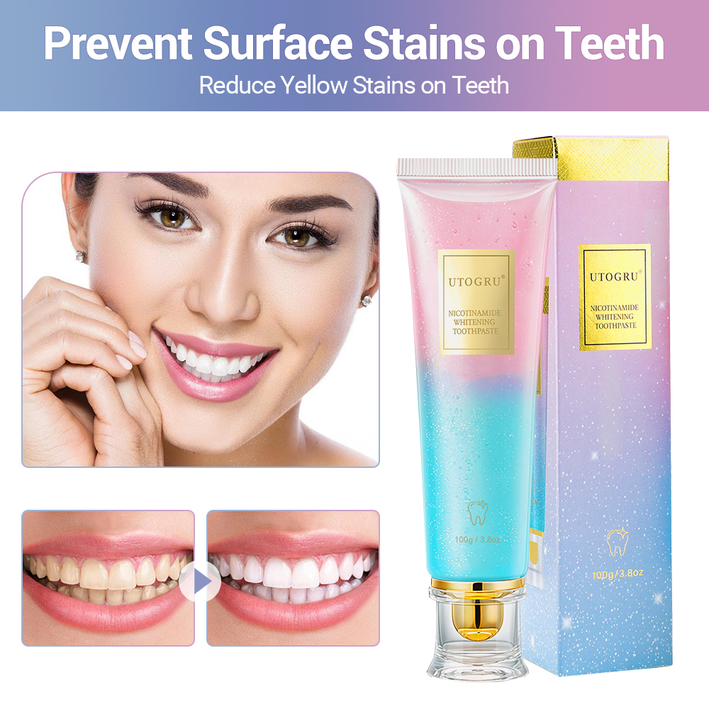 100g Niacinamide Whitening Toothpaste Refreshing Clean Teeth For Men And Women Fresh Breath Toothpaste To Remove Tooth Stains