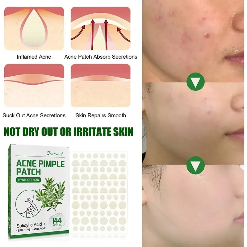 แพทช์สิวที่มองไม่เห็นแต่งหน้าที่มองไม่เห็น Clarifying แพทช์สิววงกลมปิดสิวจางเครื่องหมายสิวกันน้ําให้ความชุ่มชื้น