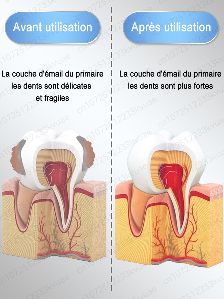 Dentifrice anti-caries reminéralisation dentaire récupération émail réparation renforcement restauration carie protection dentaire dents