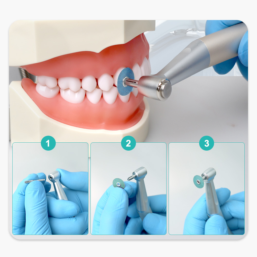 40pcs/Box Dental Composite Polishing Disc Gross Reduction Contouring Mandrel Stripes for Ceramics and Glass Ionomer Restorations