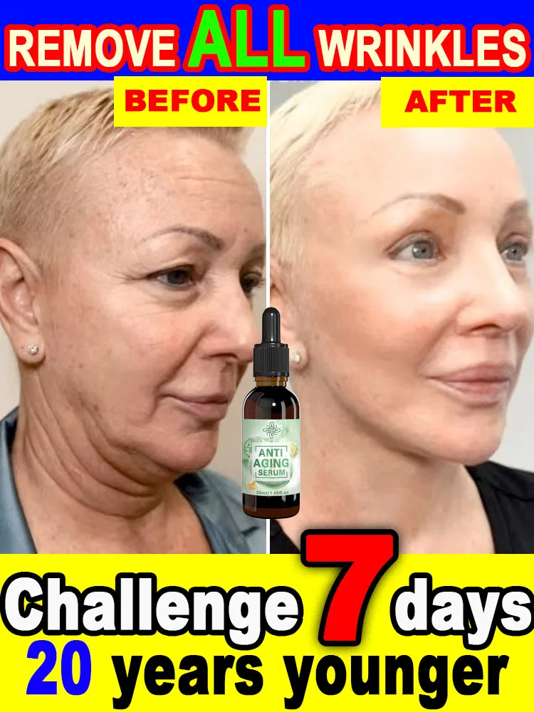 20-летний младший, без тонких линий