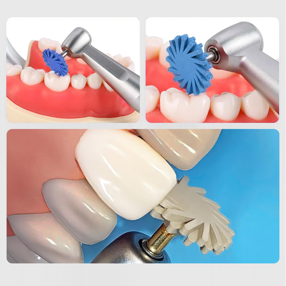 6 Stks/doos Tandrubber Polijstmachine Composiet Hars Polijsten Diamantsysteem Ra Schijf Kit 14Mm Wiel Spiraal Flex Burs Tools