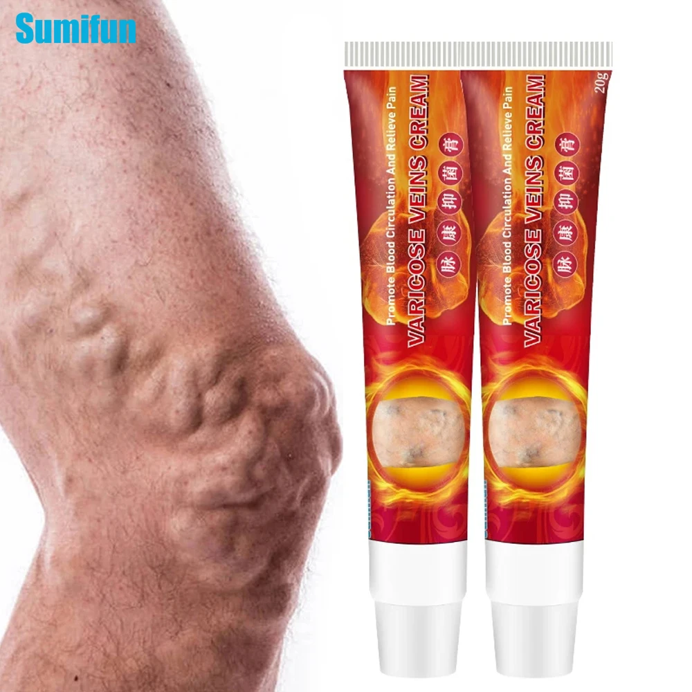 1 Cái 20G Sumifun Suy Giãn Tĩnh Mạch Kem Điều Trị Viêm Mạch Phlebitis Đùi Nhện Loại Bỏ Lò Xông Tinh Dầu Giảm Đau Y Tế Thạch Cao