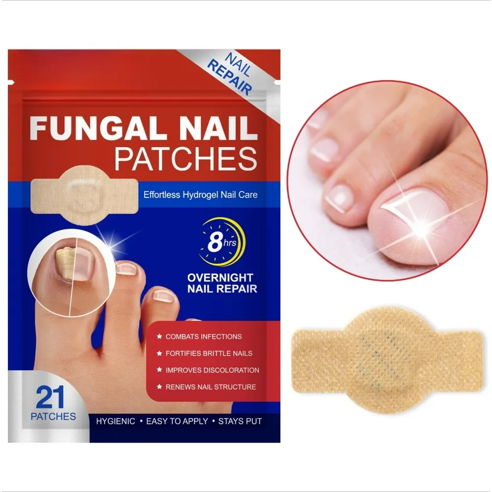 21 Uds parche para hongos en las uñas de los pies parches impermeables para reparación de uñas pegatinas de corrección encarnadas para uñas descoloridas o dañadas