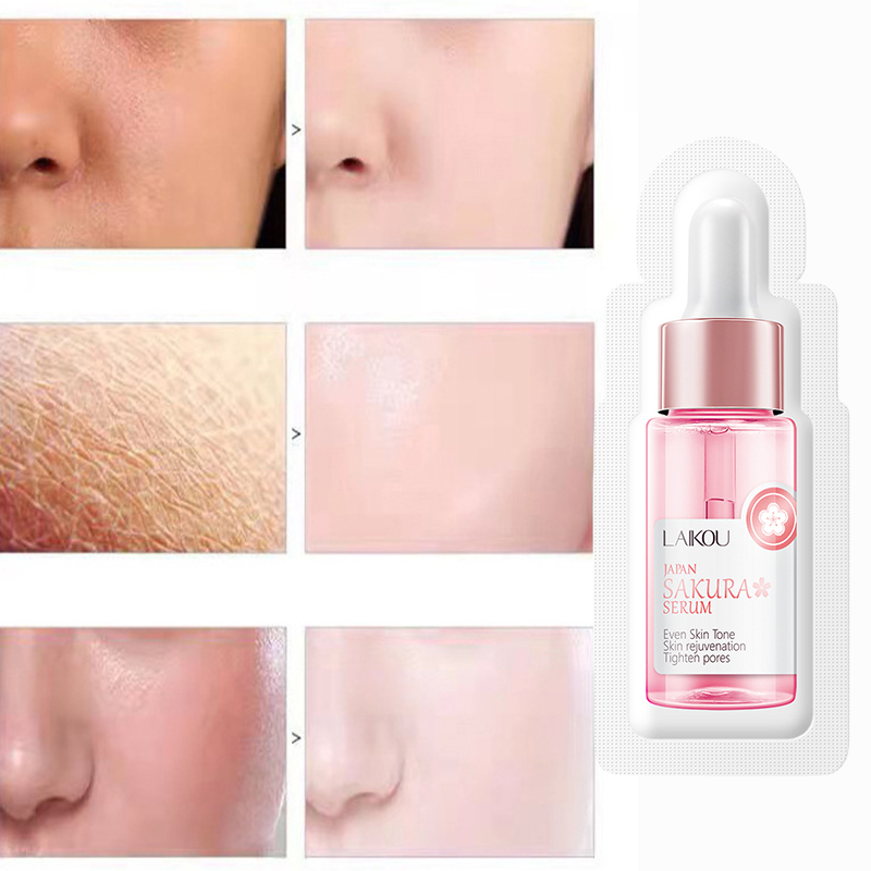 Sakura soro de cuidados faciais, rugas suaves, lifting facial, hidratante, clareamento, produtos coreanos de cuidados com a pele, 1.5ml * 3