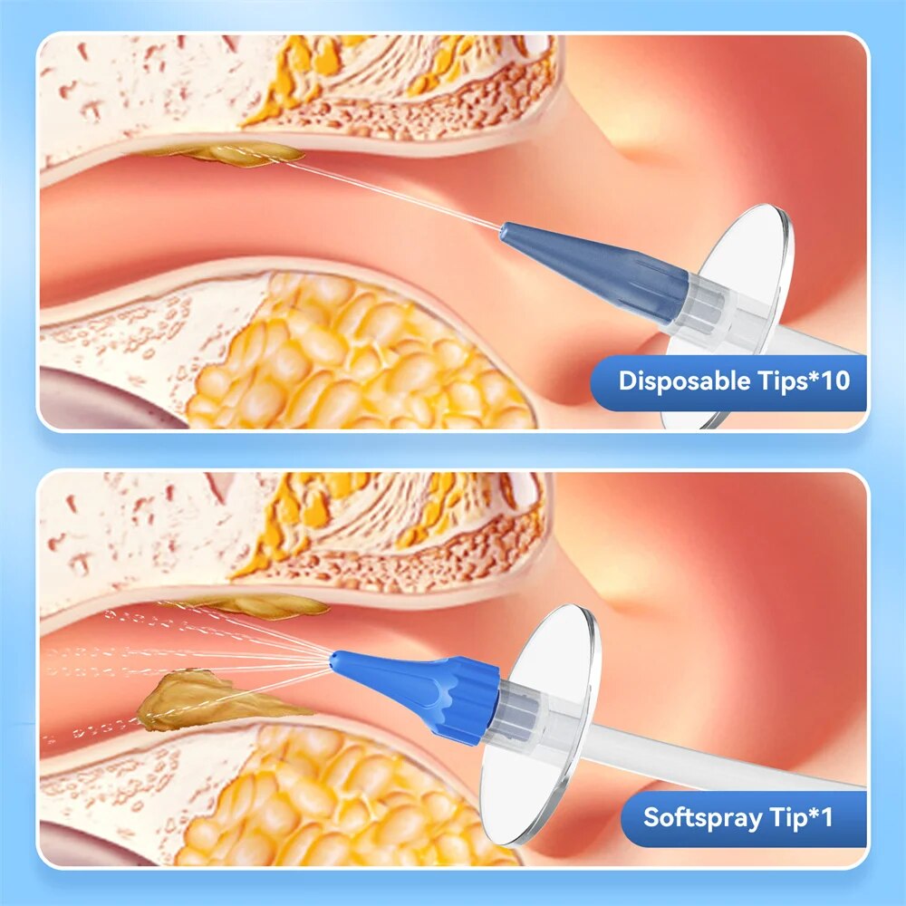 Kit de limpieza de oídos, limpiador de oídos Manual, removedor de cera de oído, sistema de lavado, cuidado saludable