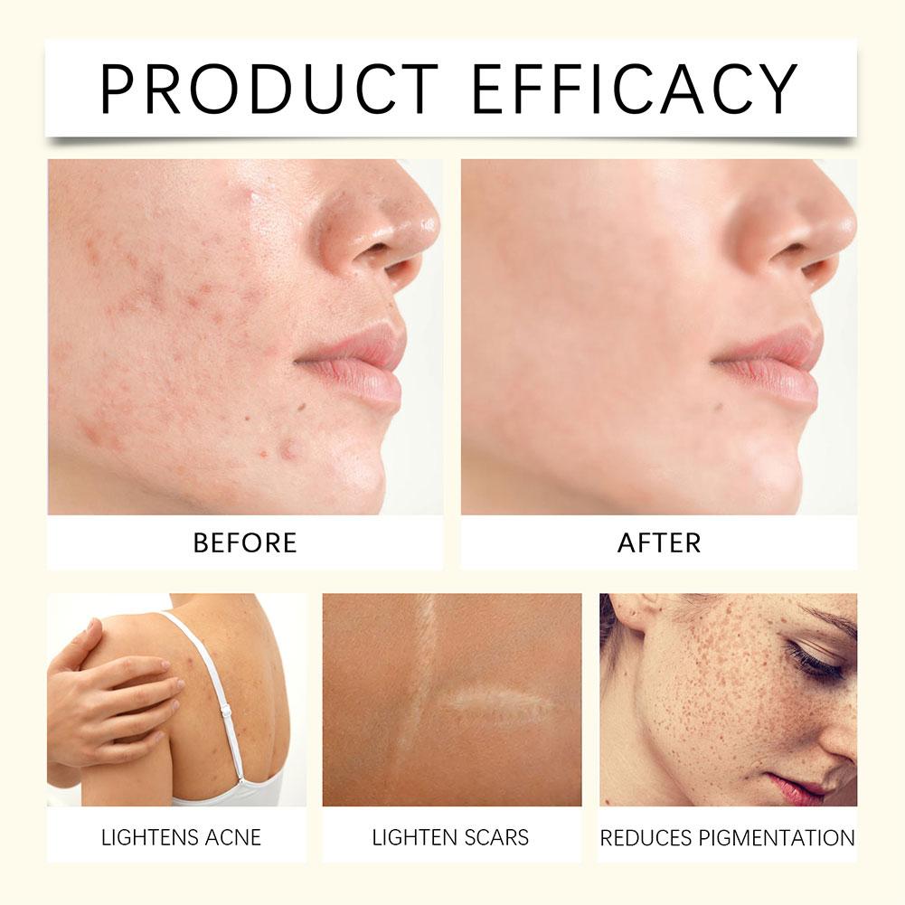 コウジ酸入りターメリックソープ,顔と体を洗い,きれいな石鹸バー,しっかりとした毛穴,輝くスキンケア,レモン,100g