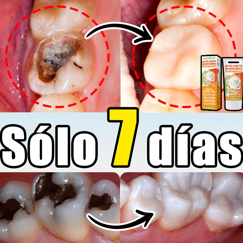 99% ᴅᴇ ᴘᴇʀsᴏɴᴀs, ʀᴇᴄᴏᴍᴘʀᴀ, sᴜᴘᴇʀᴠᴇɴᴛᴀs, ғᴀ́ᴄɪʟ ᴅᴇ ᴜsᴀʀ, ʀᴇᴘᴀʀᴀ ʟᴀ ᴄᴀʀɪᴇs ᴅᴇɴᴛᴀʟ