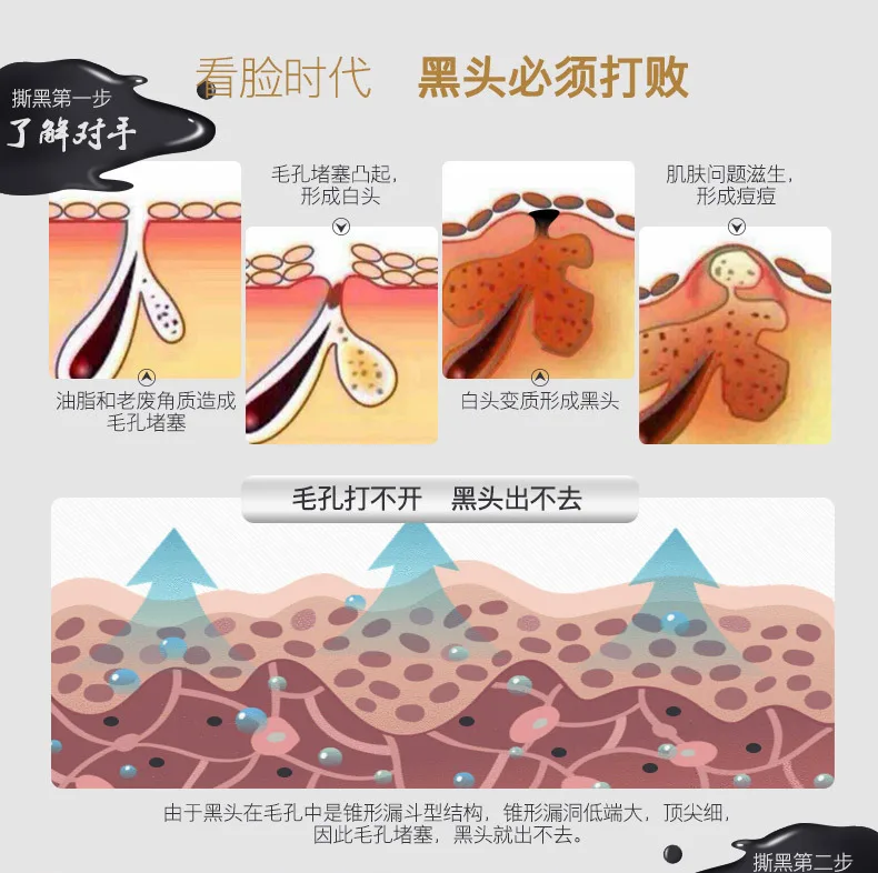 ブラックヘッドリムーバーマスク、ポアクリーナー、ブラックドット、ニキビ処理、ブラックヘッドノーズステッカー、ディープクリーニング、1個